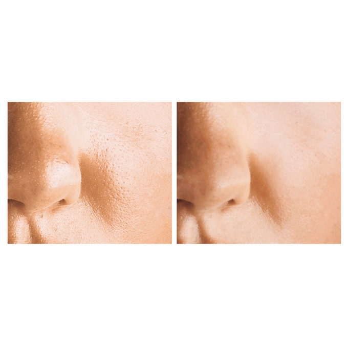 Pore Tight&trade; Facial Serum, , large