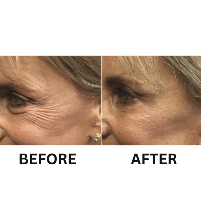 Crows Feet Eye Cream, , large