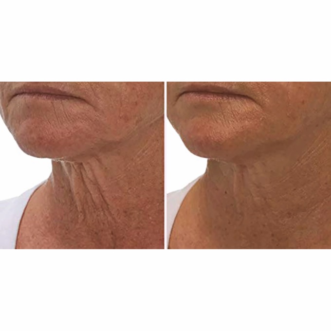 Crepe Gone Facial Souffle Anti-Aging Skin Cream, , large